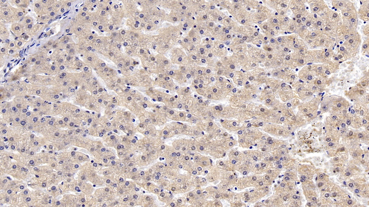 Monoclonal Antibody to Apolipoprotein B (APOB)