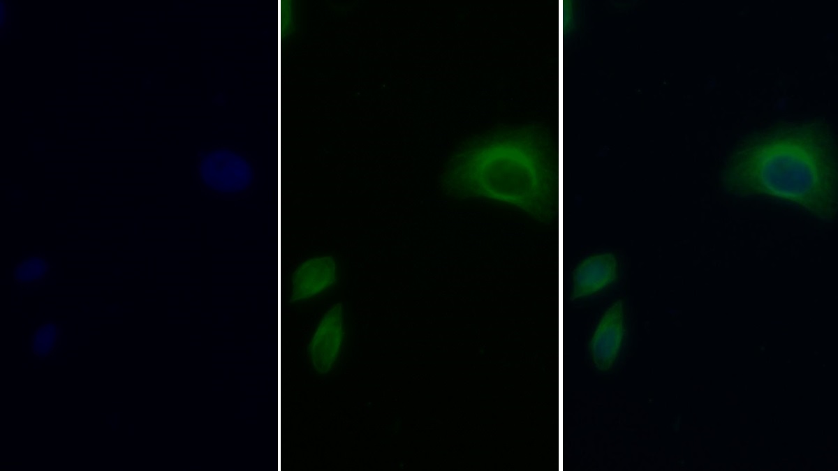 Monoclonal Antibody to Apolipoprotein B (APOB)