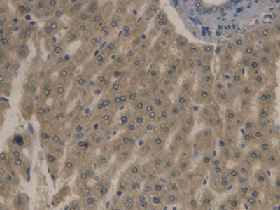 Monoclonal Antibody to Apolipoprotein B (APOB)