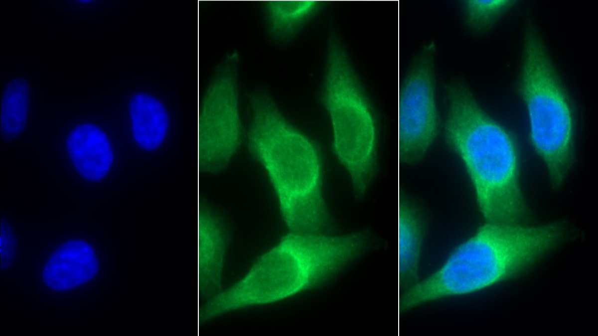 Monoclonal Antibody to Interleukin 8 Receptor Beta (IL8Rb)