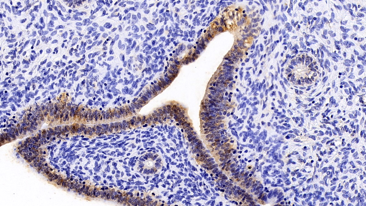 Monoclonal Antibody to S100 Calcium Binding Protein A2 (S100A2)