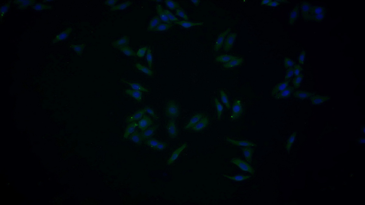 Monoclonal Antibody to Serpin A10 (SERPINA10)