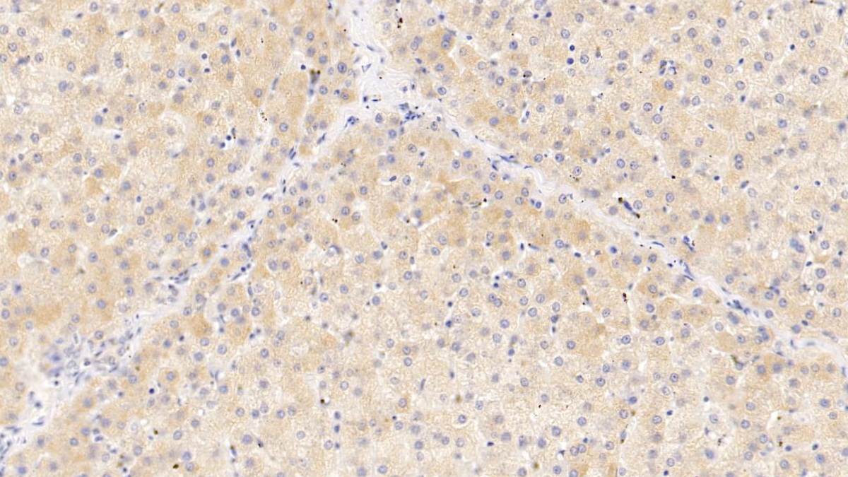 Monoclonal Antibody to Serpin A10 (SERPINA10)