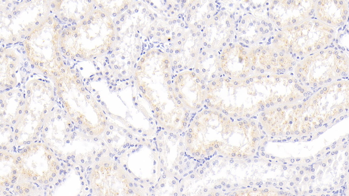 Monoclonal Antibody to S100 Calcium Binding Protein A3 (S100A3)