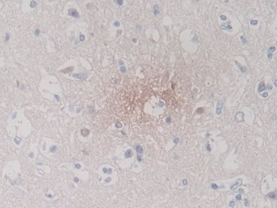 Monoclonal Antibody to S100 Calcium Binding Protein A5 (S100A5)