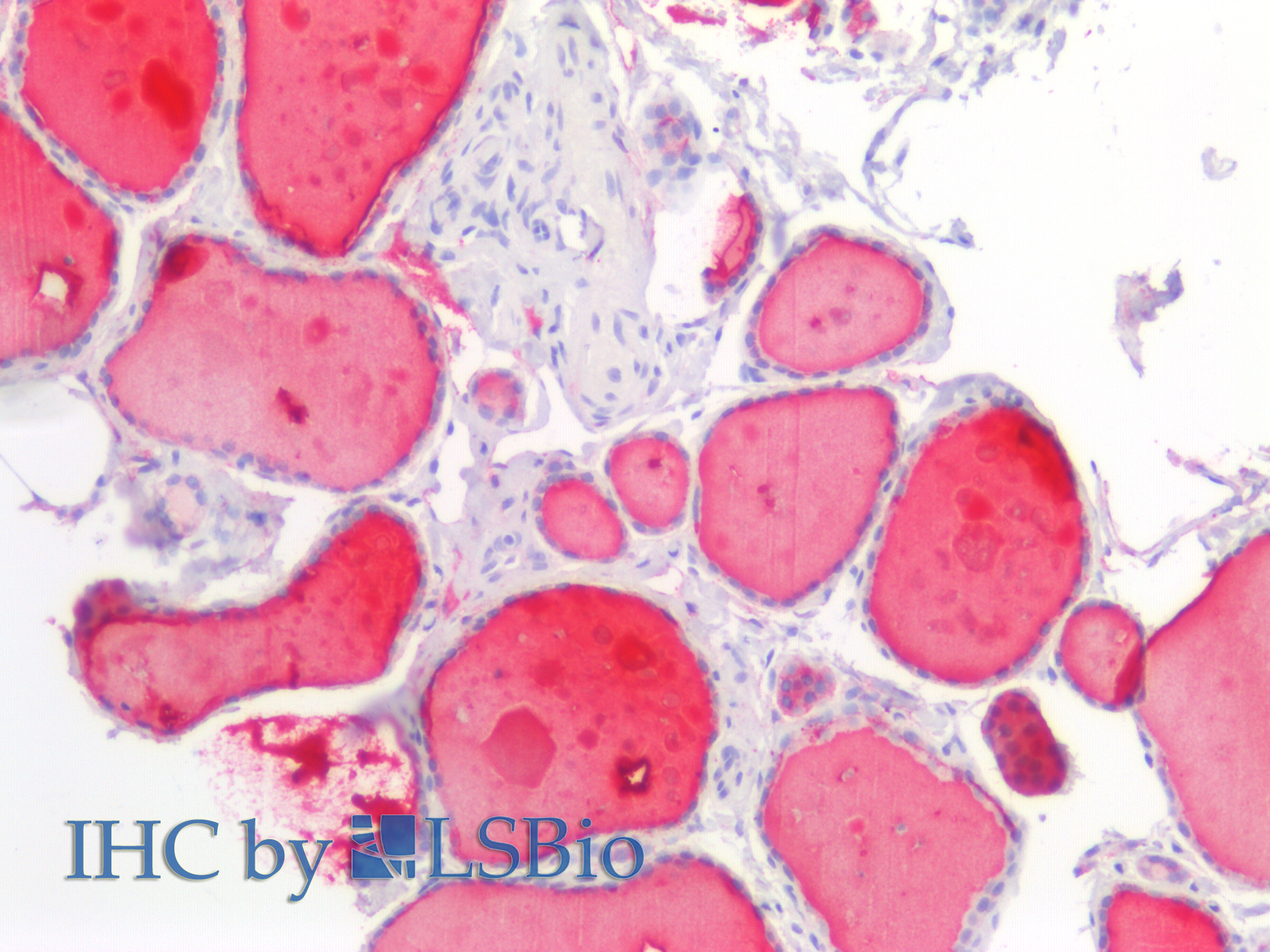 Monoclonal Antibody to Reverse Triiodothyronine (rT3)