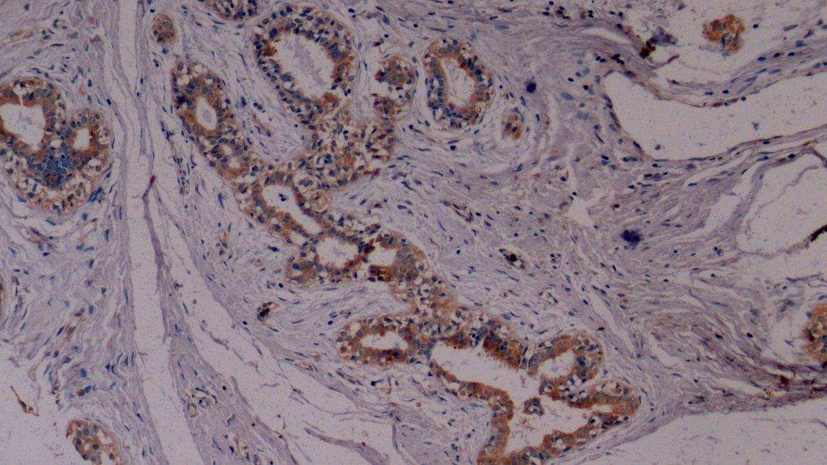 Monoclonal Antibody to Cytokeratin 8 (CK8)