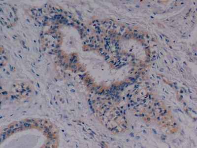 Monoclonal Antibody to Cytokeratin 8 (CK8)