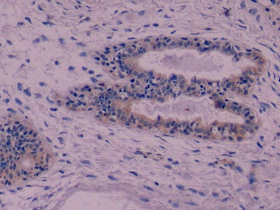 Monoclonal Antibody to Cytokeratin 8 (CK8)