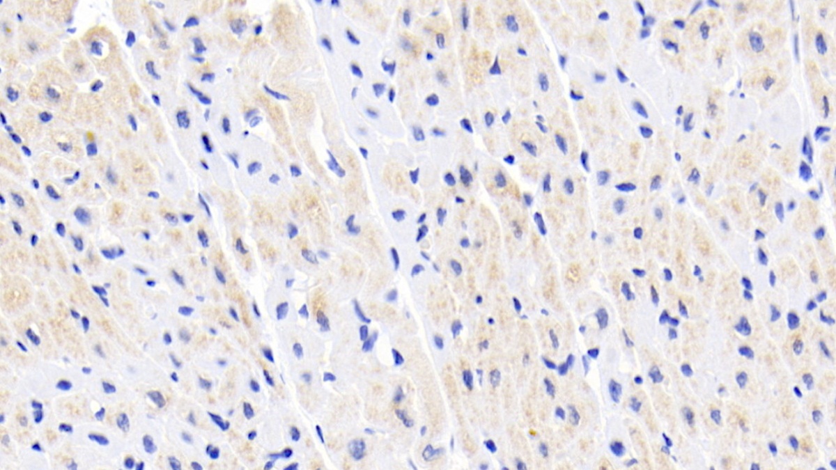 Monoclonal Antibody to Creatine Kinase B (CK-BB)