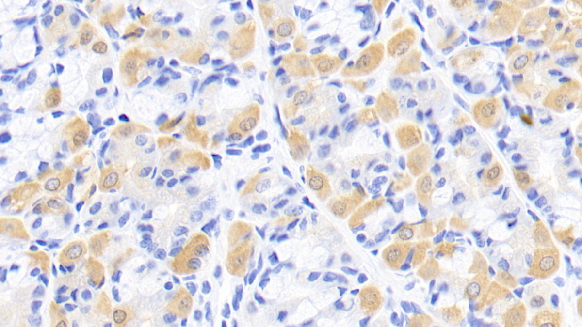 Monoclonal Antibody to Creatine Kinase B (CK-BB)