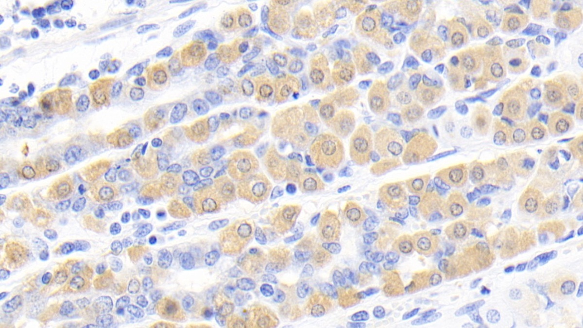 Monoclonal Antibody to Creatine Kinase B (CK-BB)