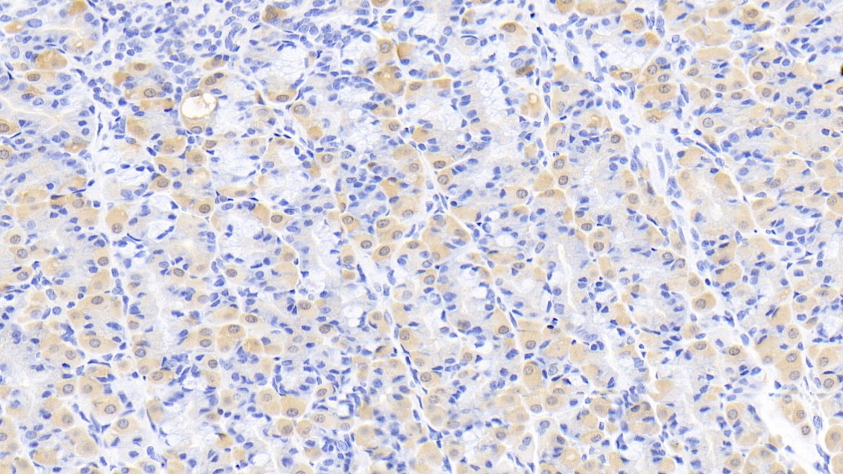 Monoclonal Antibody to Creatine Kinase B (CK-BB)