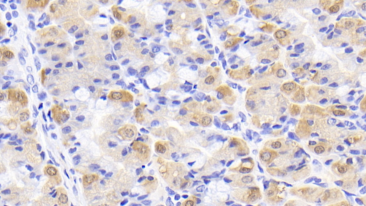 Monoclonal Antibody to Creatine Kinase B (CK-BB)