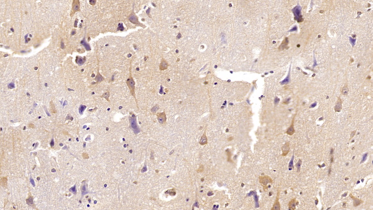 Monoclonal Antibody to Interleukin 22 (IL22)