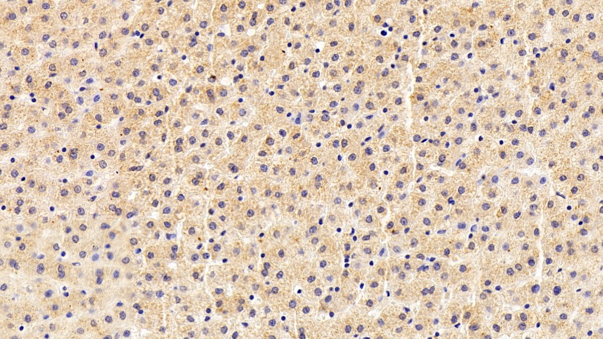 Monoclonal Antibody to Transferrin (TF)