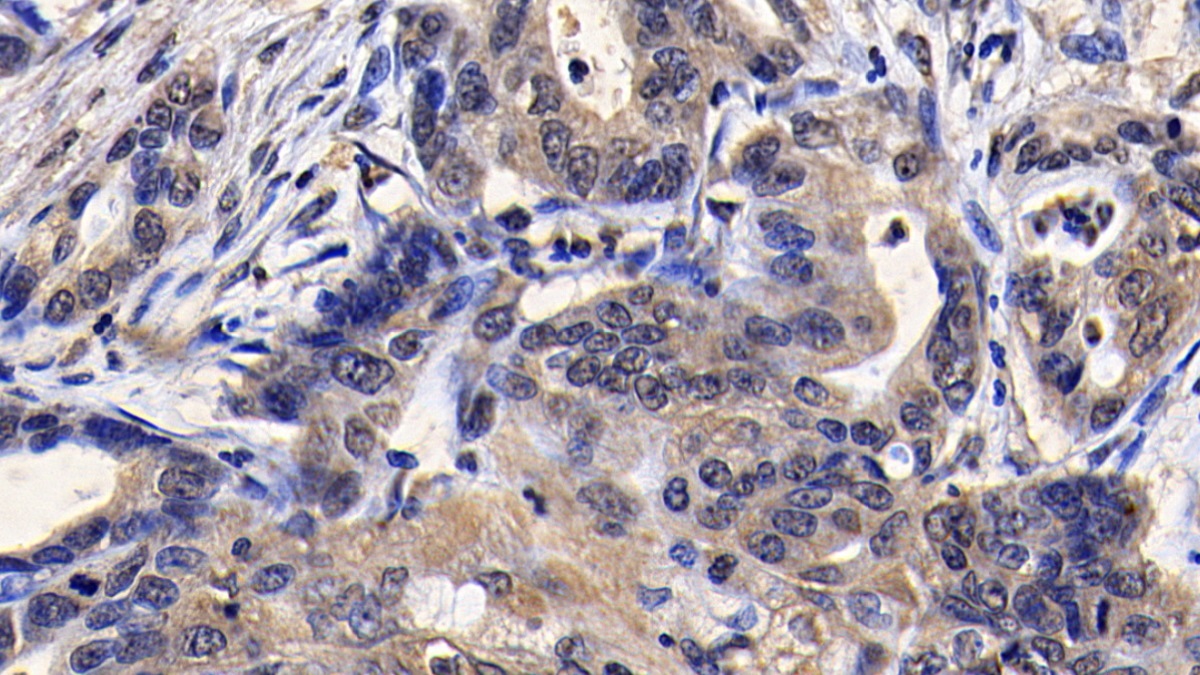 Monoclonal Antibody to Survivin (Surv)