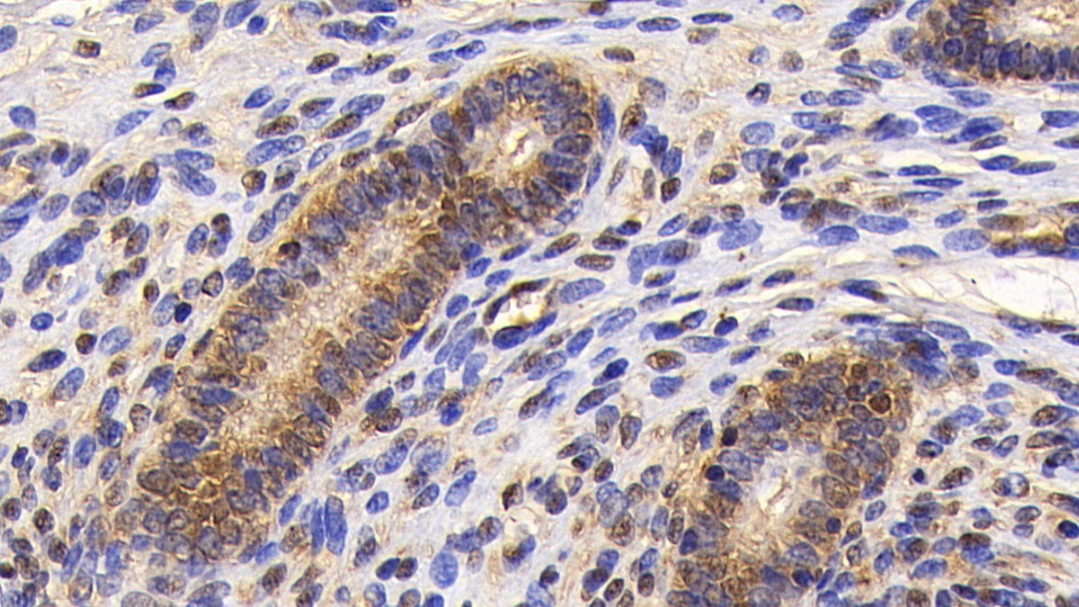 Monoclonal Antibody to Survivin (Surv)