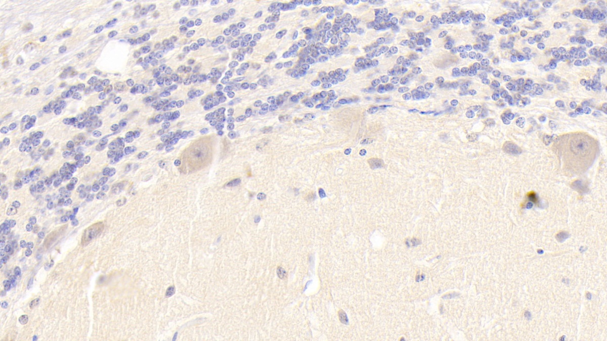 Monoclonal Antibody to Phospholipase B (PLB)