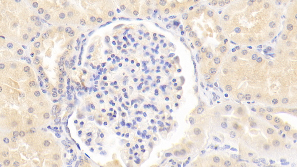 Monoclonal Antibody to Laminin Alpha 3 (LAMa3)