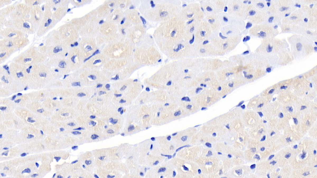 Monoclonal Antibody to Activin A Receptor Type II A (ACVR2A)