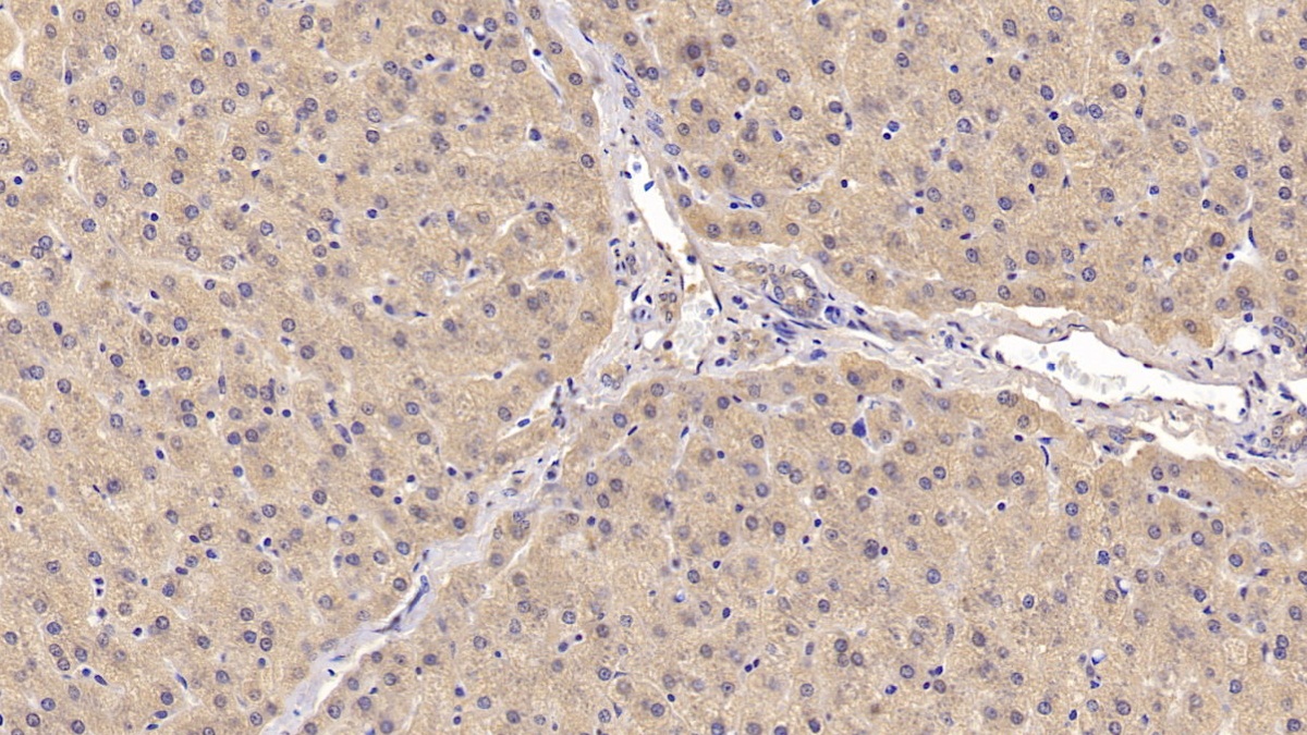 Monoclonal Antibody to Activin A Receptor Type II A (ACVR2A)