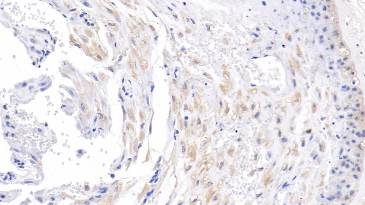 Monoclonal Antibody to Activin A Receptor Type II A (ACVR2A)