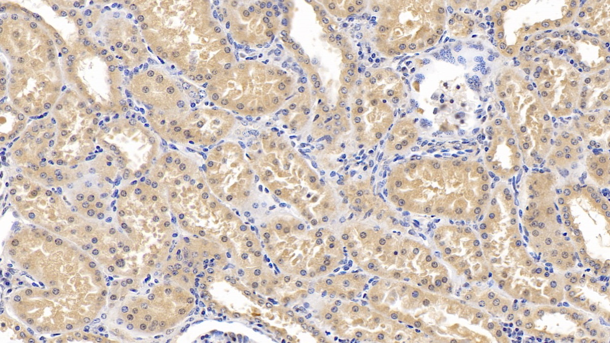 Monoclonal Antibody to SMAD family member 3 (SMAD3)