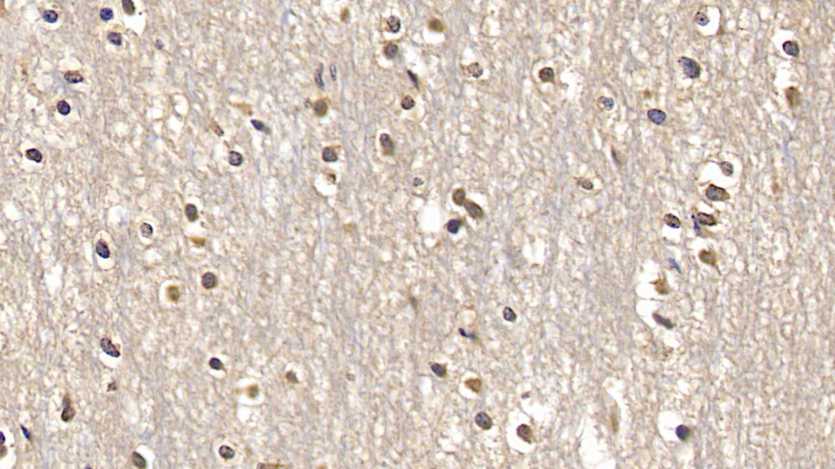 Monoclonal Antibody to SMAD family member 3 (SMAD3)