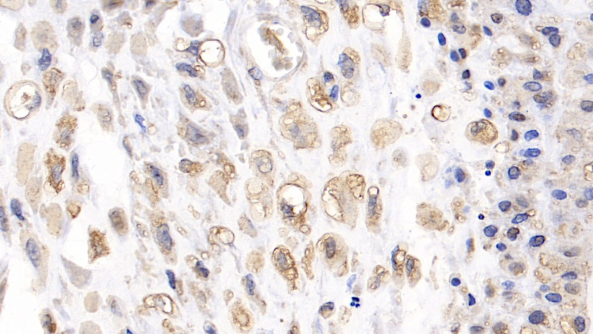 Monoclonal Antibody to SMAD family member 3 (SMAD3)