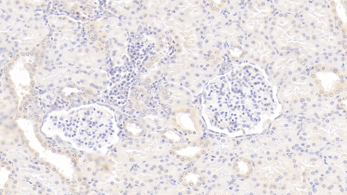 Monoclonal Antibody to Gremlin 1 (GREM1)