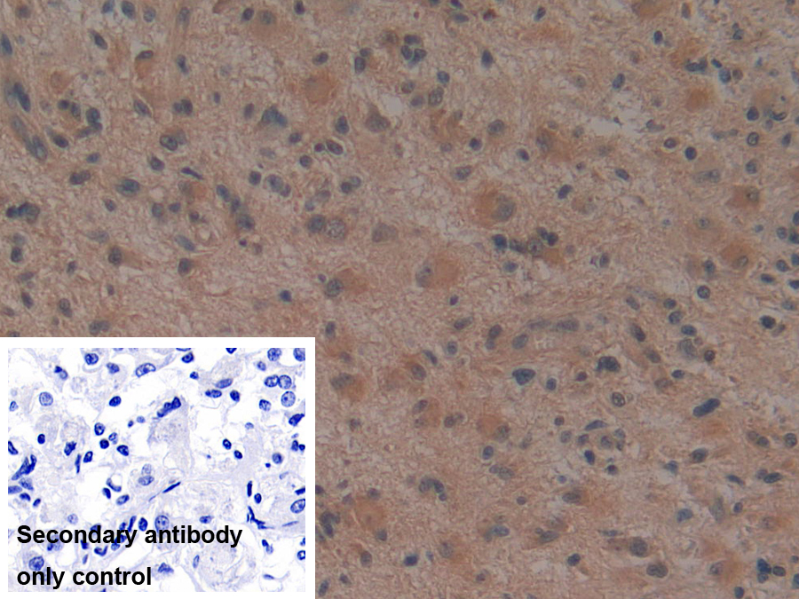 Monoclonal Antibody to Noggin (NOG)