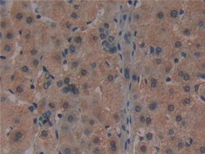 Monoclonal Antibody to Noggin (NOG)