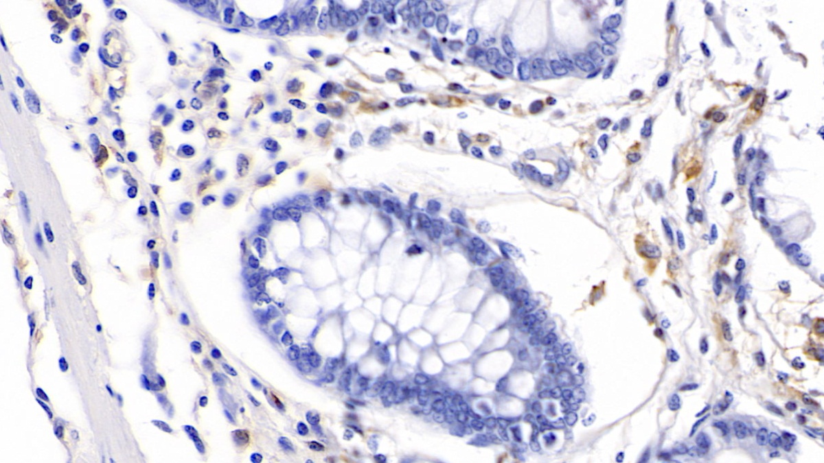 Monoclonal Antibody to HLA Class II Histocompatibility Antigen, DRB1 Beta Chain (HLA-DRB1)