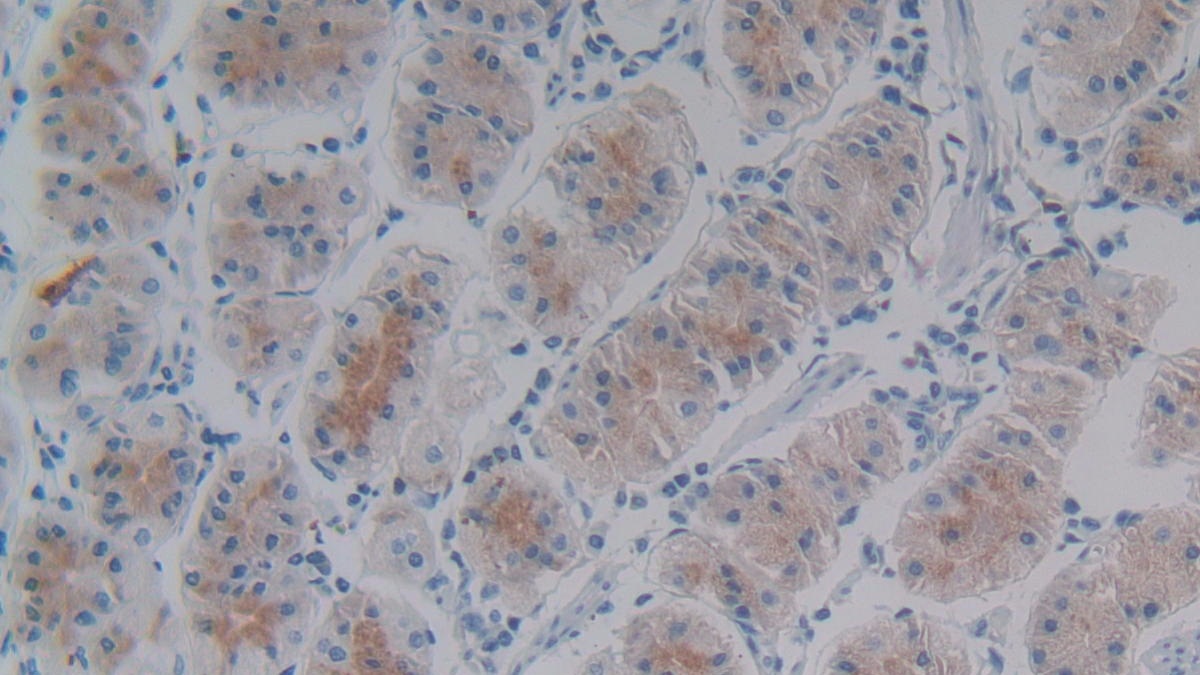 Monoclonal Antibody to Left/Right Determination Factor 1 (LEFTY1)