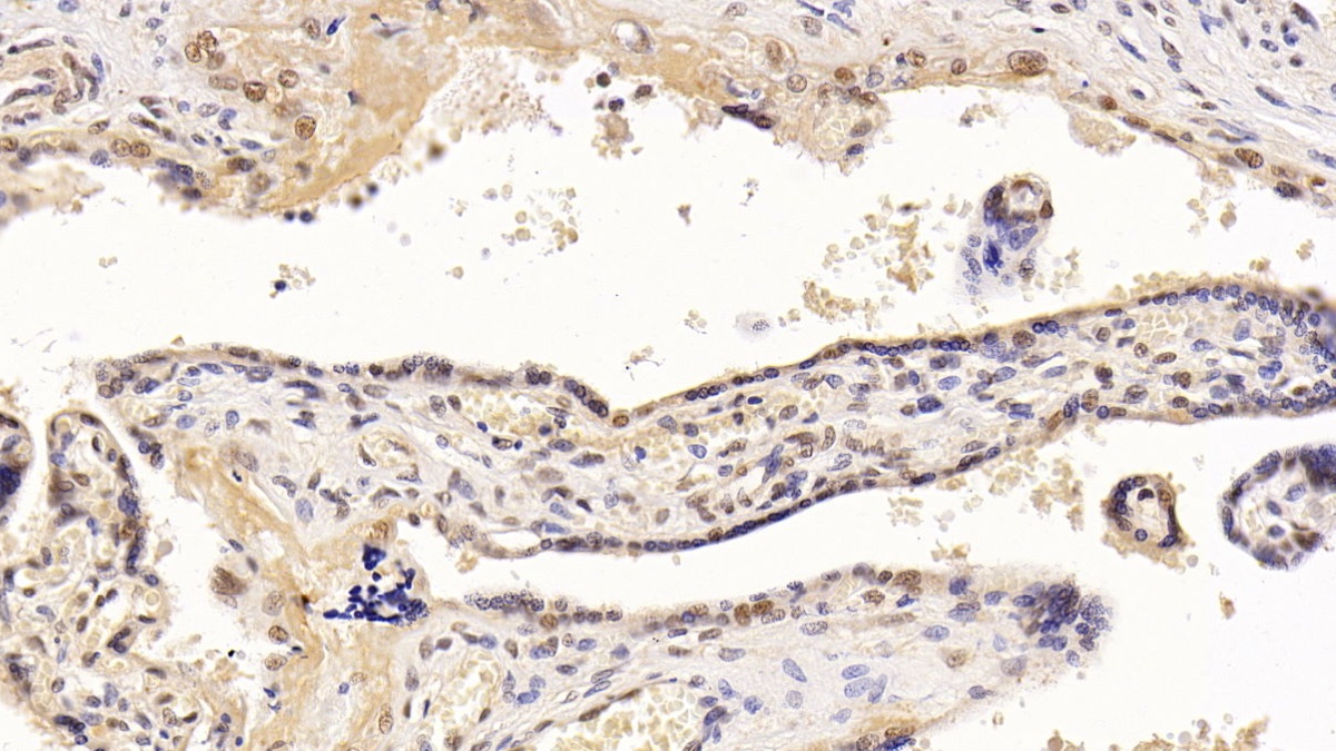 Monoclonal Antibody to Histone Deacetylase 1 (HDAC1)