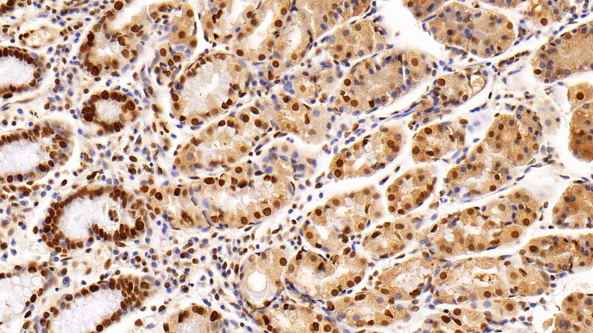 Monoclonal Antibody to Histone Deacetylase 1 (HDAC1)