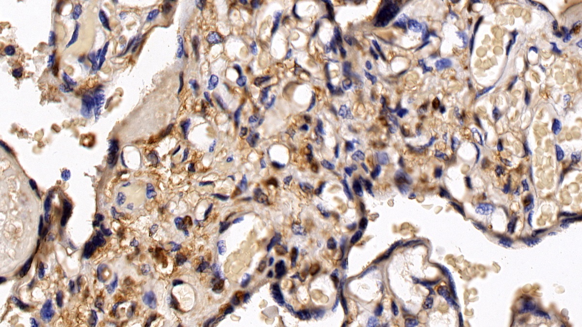 Monoclonal Antibody to Histone Deacetylase 1 (HDAC1)