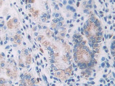 Monoclonal Antibody to Anterior Gradient 2 (AGR2)