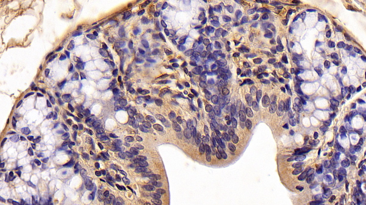 Monoclonal Antibody to Anterior Gradient 2 (AGR2)