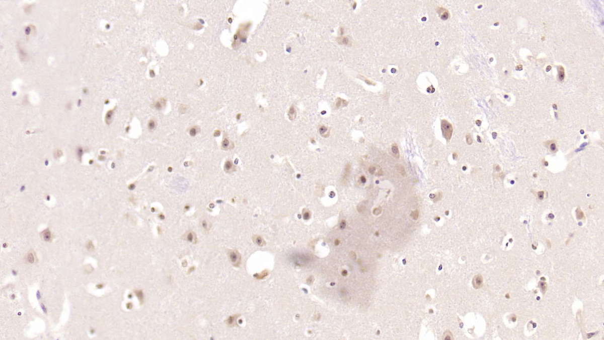 Monoclonal Antibody to Mesencephalic Astrocyte Derived Neurotrophic Factor (MANF)