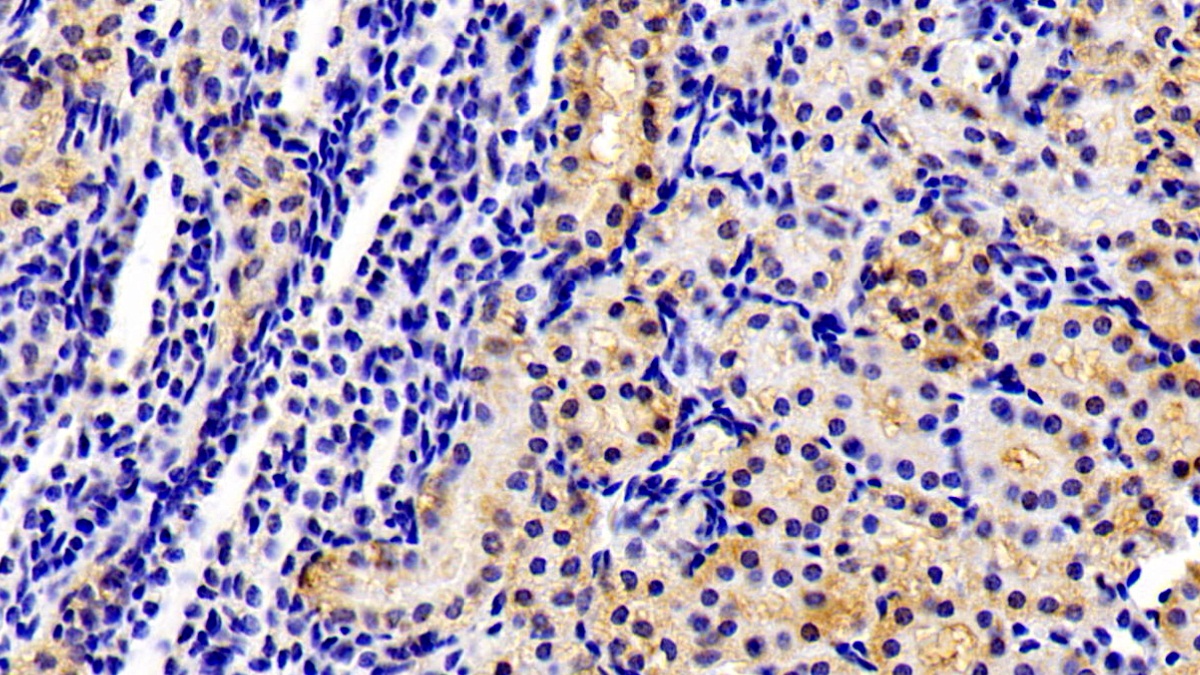 Monoclonal Antibody to Antithrombin (AT)