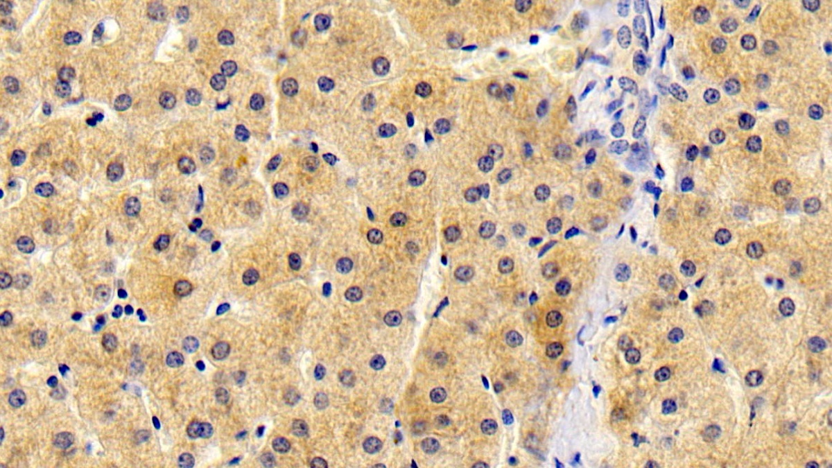 Monoclonal Antibody to Antithrombin (AT)