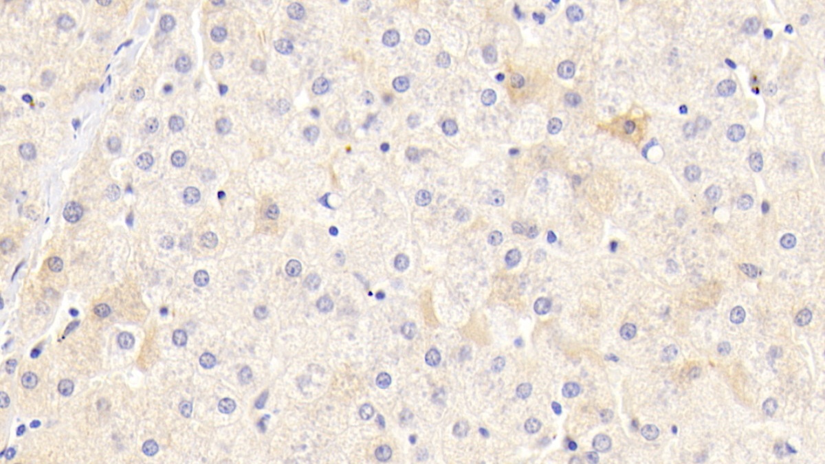 Monoclonal Antibody to Antithrombin (AT)