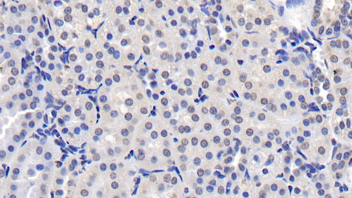 Monoclonal Antibody to Nuclear Mitotic Apparatus Protein 1 (NUMA1)