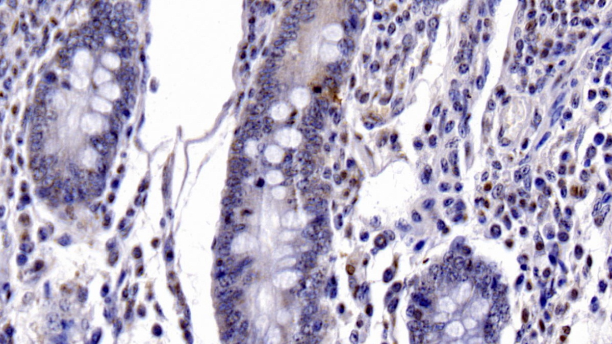 Monoclonal Antibody to Caspase 6 (CASP6)