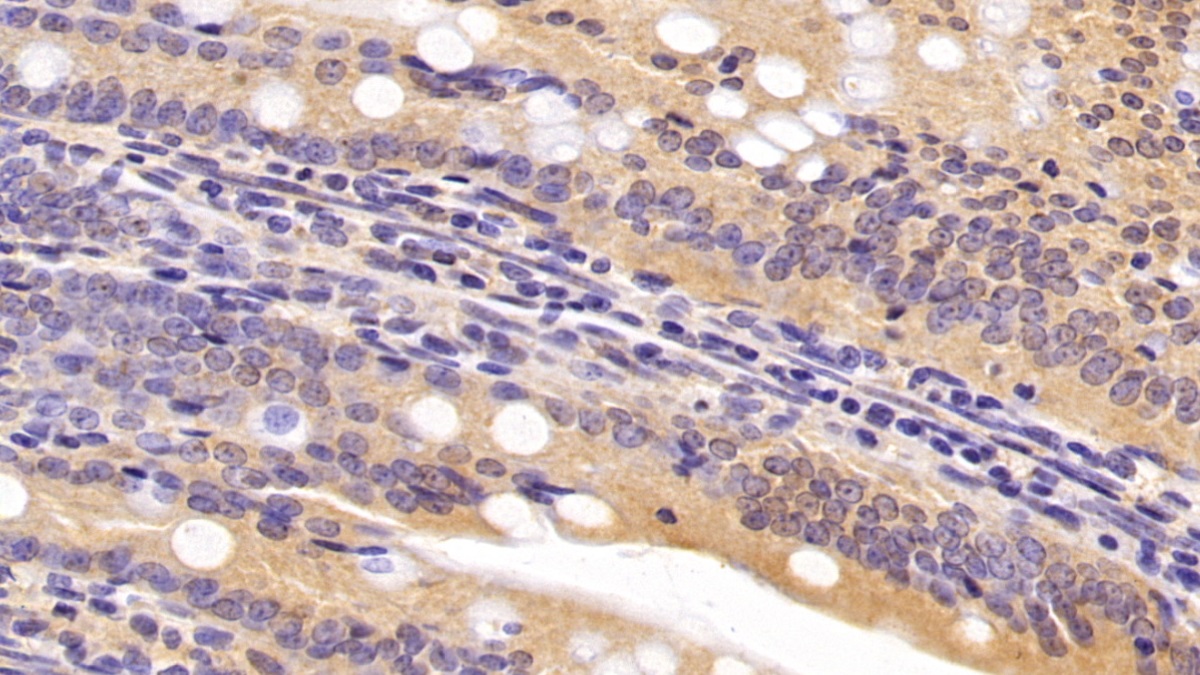 Monoclonal Antibody to Caspase 6 (CASP6)