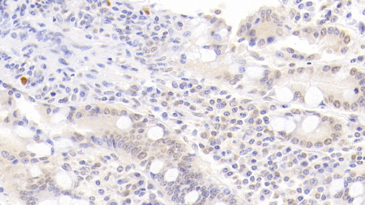 Monoclonal Antibody to Caudal Type Homeobox 2 (CDX2)