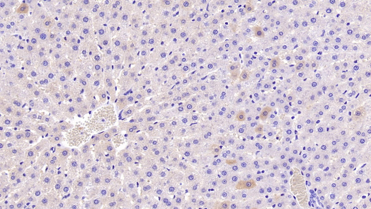 Monoclonal Antibody to Carnitine Acetyltransferase (CRAT)