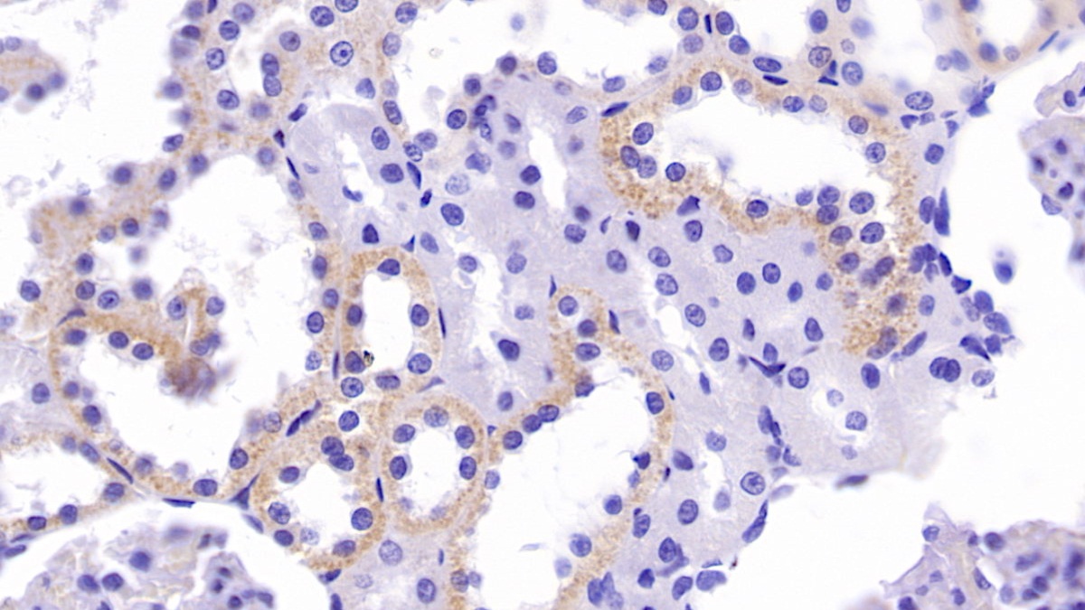 Monoclonal Antibody to Carnitine Acetyltransferase (CRAT)